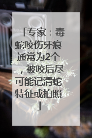 专家：毒蛇咬伤牙痕通常为2个，被咬后尽可能记清蛇特征或拍照